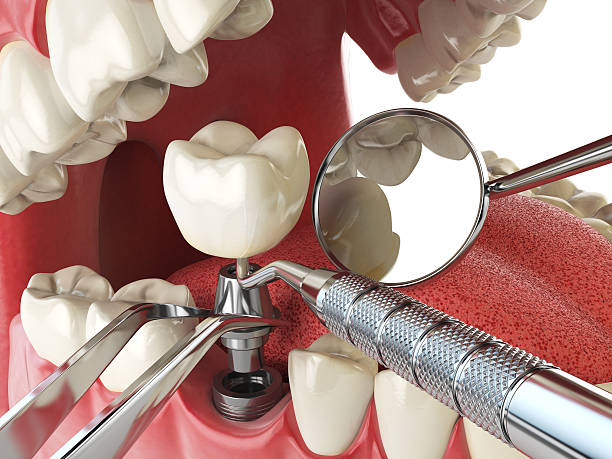 Best Weekend Emergency Dentist in Lufkin, TX